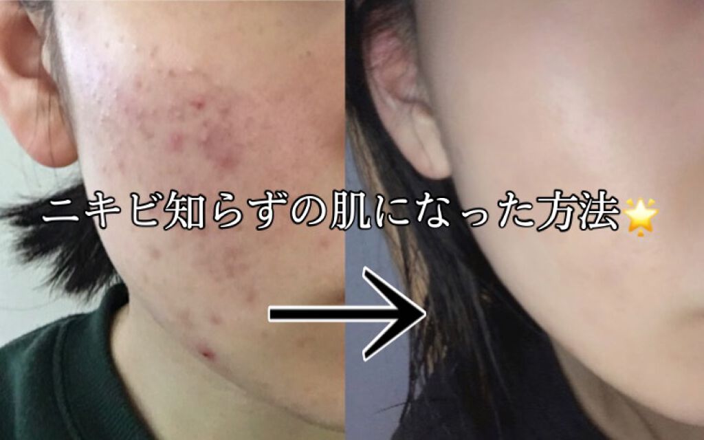 化粧水・敏感肌用・高保湿タイプ/無印良品/化粧水を使ったクチコミ（1枚目）