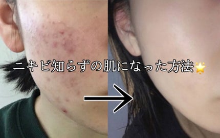 化粧水・敏感肌用・高保湿タイプ/無印良品/化粧水を使ったクチコミ(1枚目)