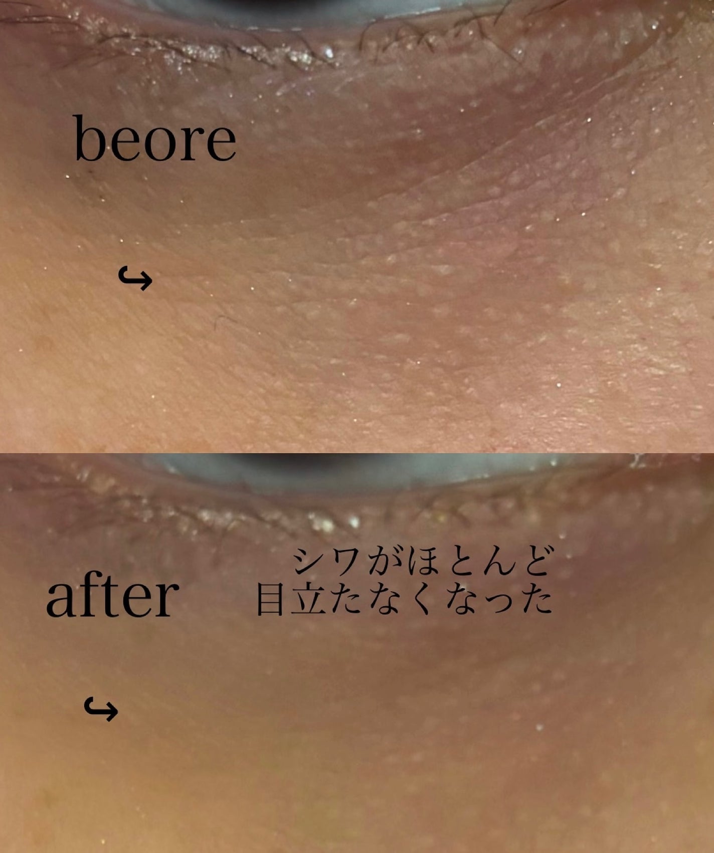 コスメコンシェルジュの美容図鑑 on LIPS 「本日ご紹介するのは、サムブロッサム様からいただきました、スピキ..」(3枚目)