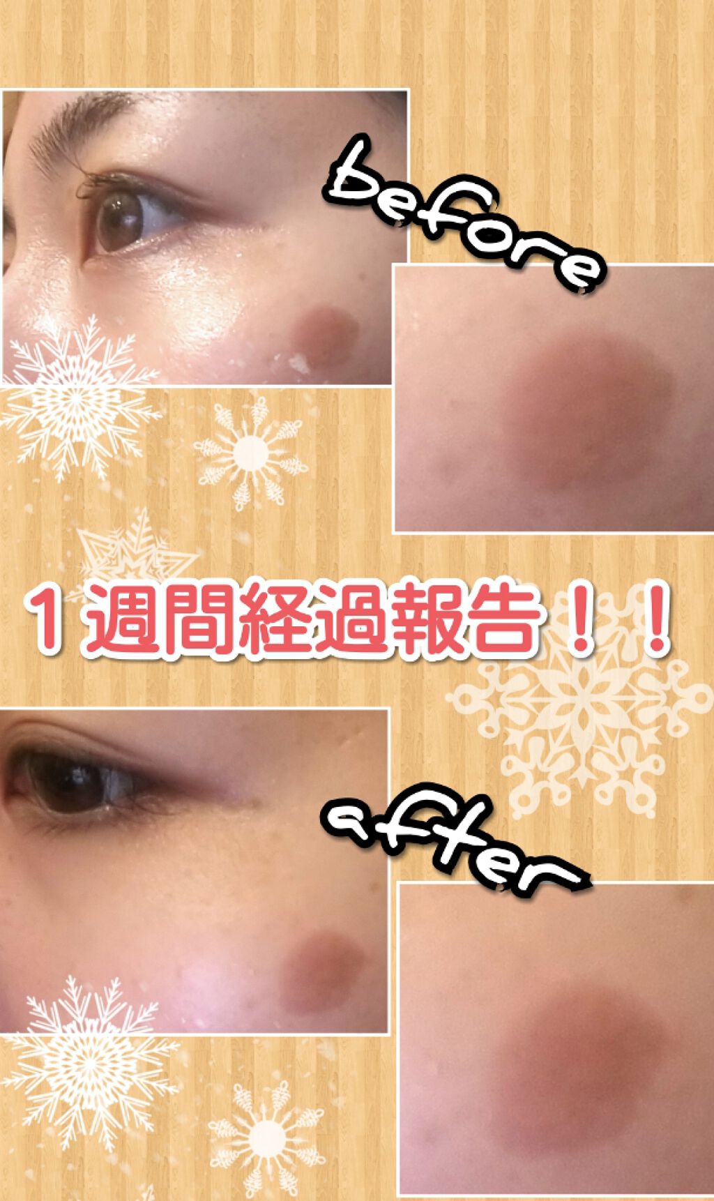 メラノフォーカスV/HAKU/美容液を使ったクチコミ(2枚目)