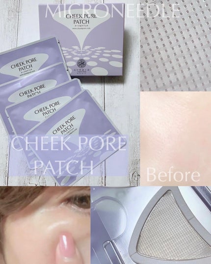 チークポアパッチ/北の快適工房/シートマスク・パックを使ったクチコミ(4枚目)