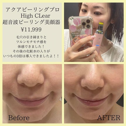 を使ったクチコミ(2枚目)