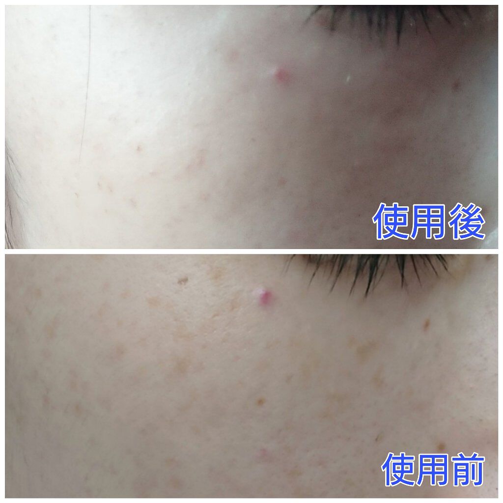 Beauty Function/ReBion/美容液を使ったクチコミ（2枚目）