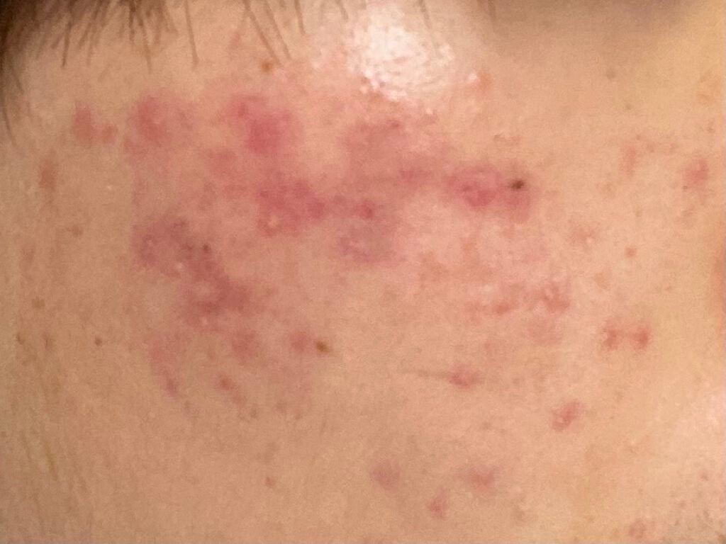 shiny_cosme_amgz on LIPS 「3ヶ月前#はじめての投稿..」(2枚目)