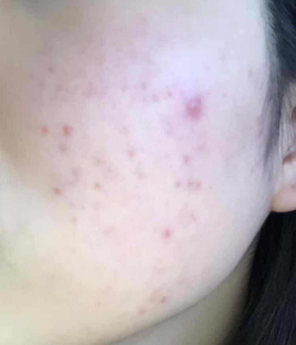 ハトムギ保湿ジェル(ナチュリエ スキンコンディショニングジェル)/ナチュリエ/美容液を使ったクチコミ（3枚目）