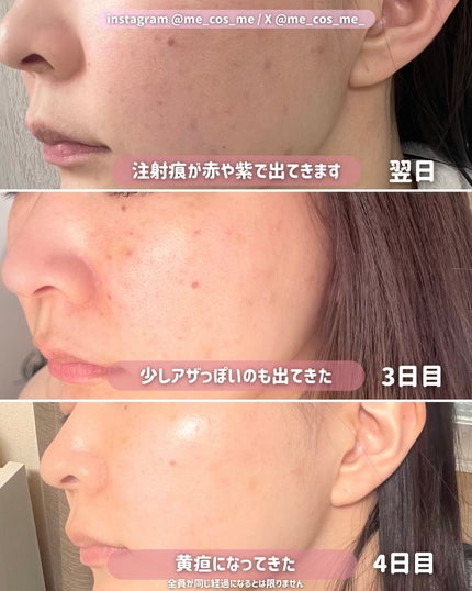 með¥éåœã³ã¹ã¡ç ç©¶å®¶ on LIPS ãéåœã·ã³ãã³ãã§ã³é§
ããã®ãµã³ãã¥ãŒå»é¢ðïžæ°ã«ãªãã·ã¯ãæ¯ç©Ž..ãïŒ9æç®ïŒ