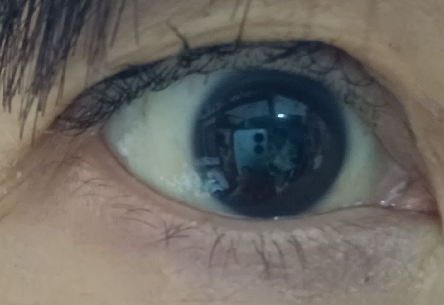 オリシキ アイリッドスキンフィルム /D-UP/二重まぶた用アイテムを使ったクチコミ(4枚目)