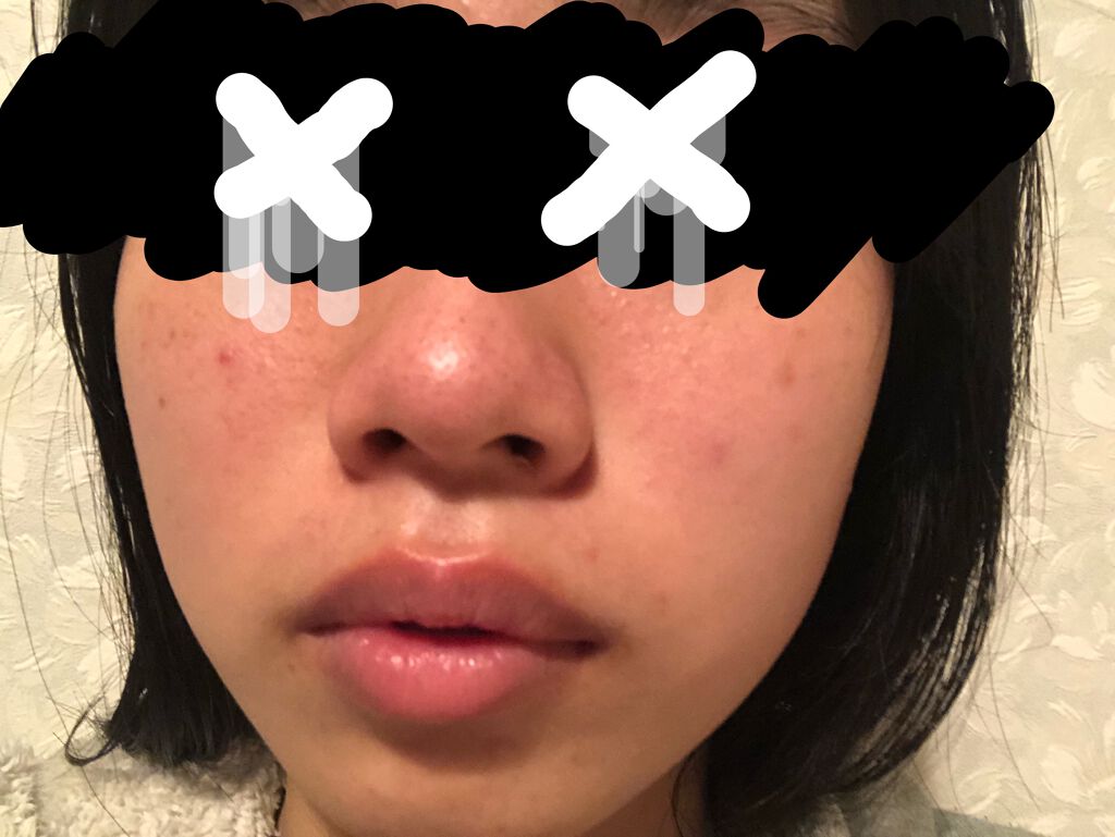 艶肌ドロップ/ラッシュ/美容液を使ったクチコミ（3枚目）