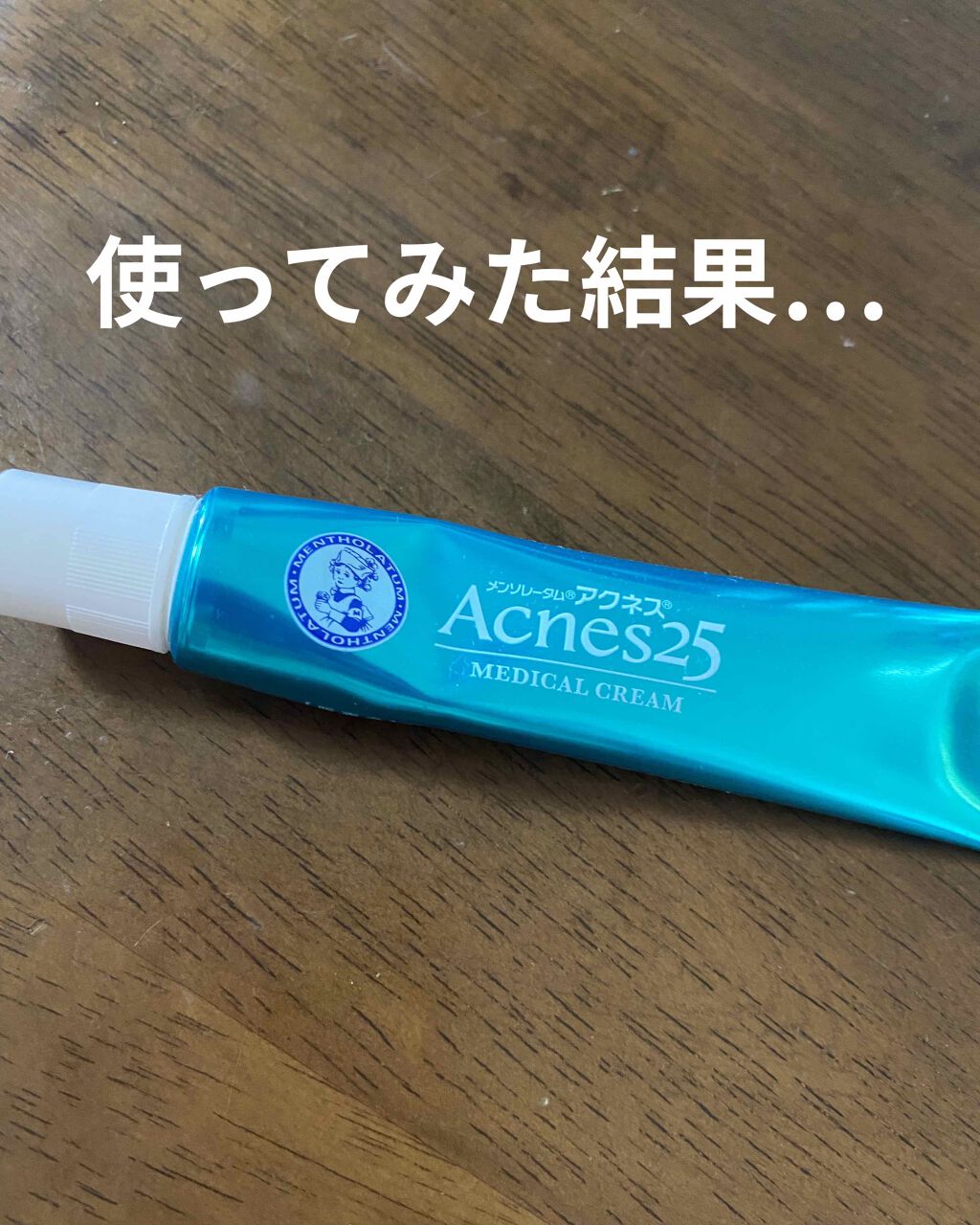 メディカルクリームc(医薬品)/メンソレータム アクネス25/その他を使ったクチコミ(1枚目)