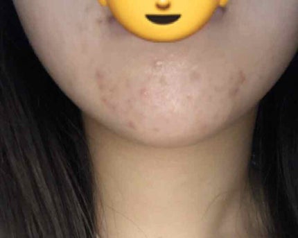 敏感肌用薬用美白美容液/無印良品/美容液を使ったクチコミ(2枚目)