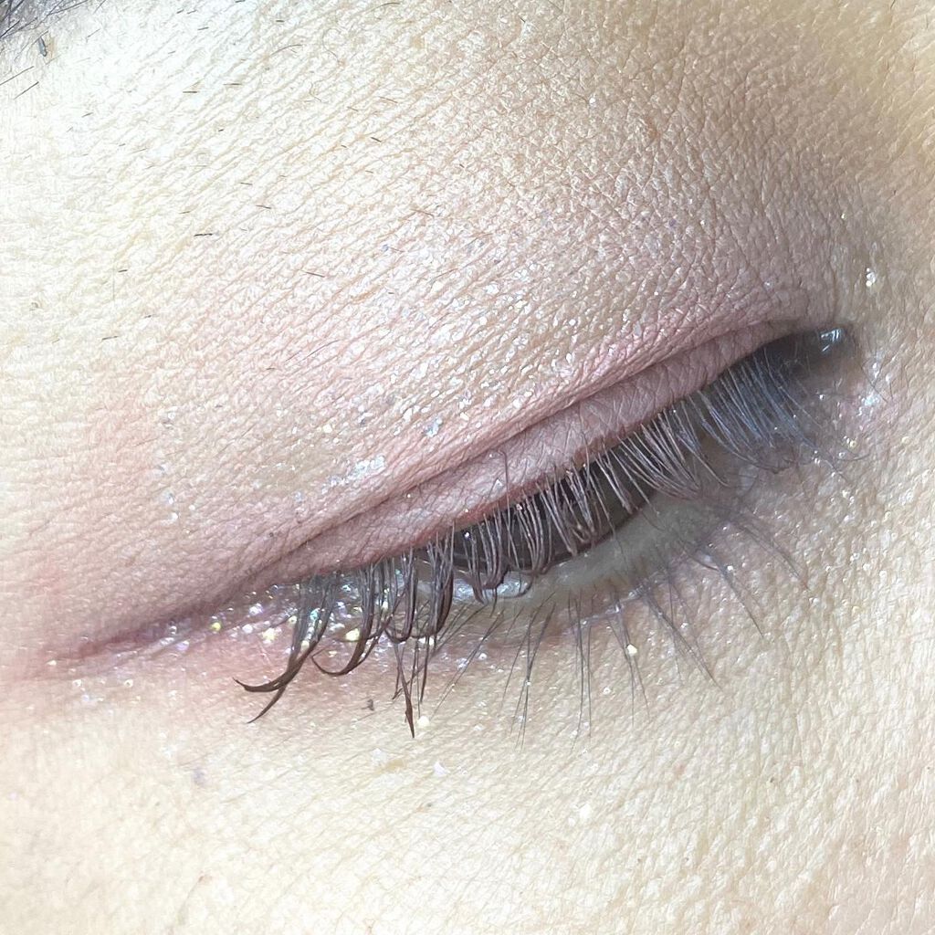 ð«ð·ããã³ on LIPS ãç
ãããªããç®å
ã±ã¢ãŸã§âšLinoueïŒãªããšïŒããžã¥ãšãªãã¿..ãïŒ5æç®ïŒ