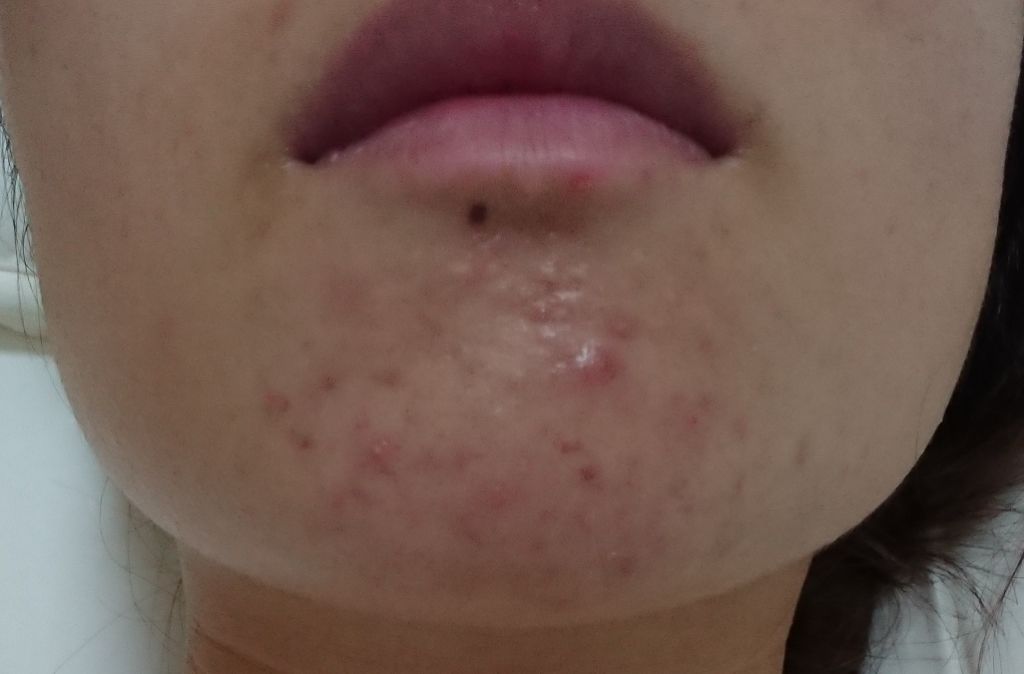 ロゼット 洗顔パスタ　荒性肌/ロゼット/洗顔フォームを使ったクチコミ（2枚目）