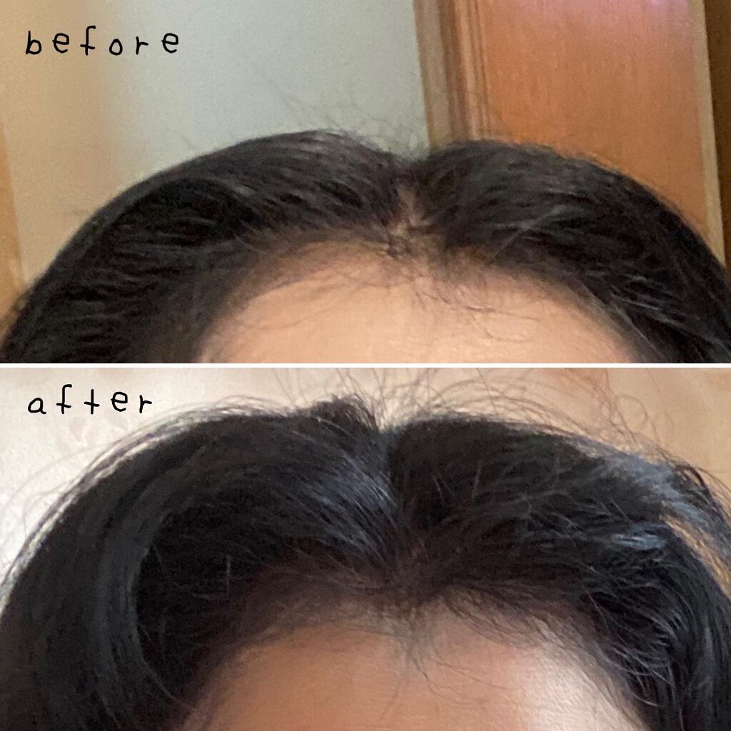 miyako_candy on LIPS ãðNaturesforã¹ã«ã«ãã¯ã³ããŒããŒã·ã§ã³&ããŒã©ãŒã»ã..ãïŒ5æç®ïŒ