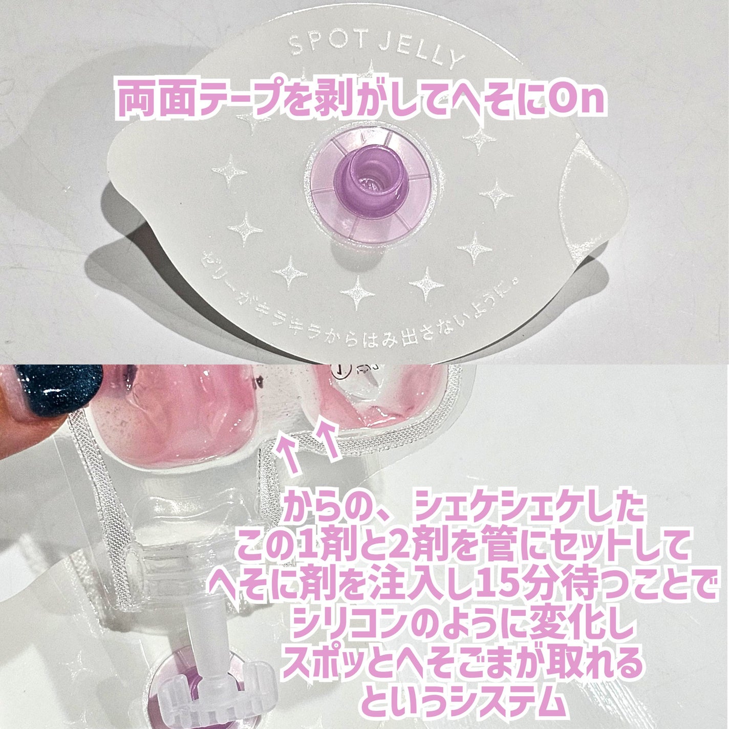 SPOT JELLY(スポッ!とジェリー)へそごまパック/花王/その他スキンケアを使ったクチコミ(6枚目)