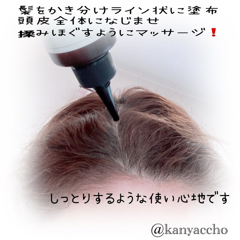 ナノグロウリッチ/iqumore/頭皮ローションを使ったクチコミ（3枚目）