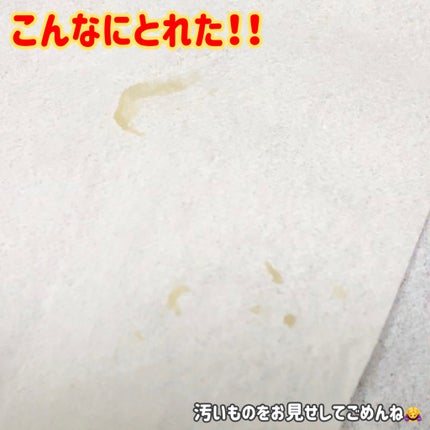 ディープクリーンマスター/ilso/その他スキンケアグッズを使ったクチコミ(5枚目)