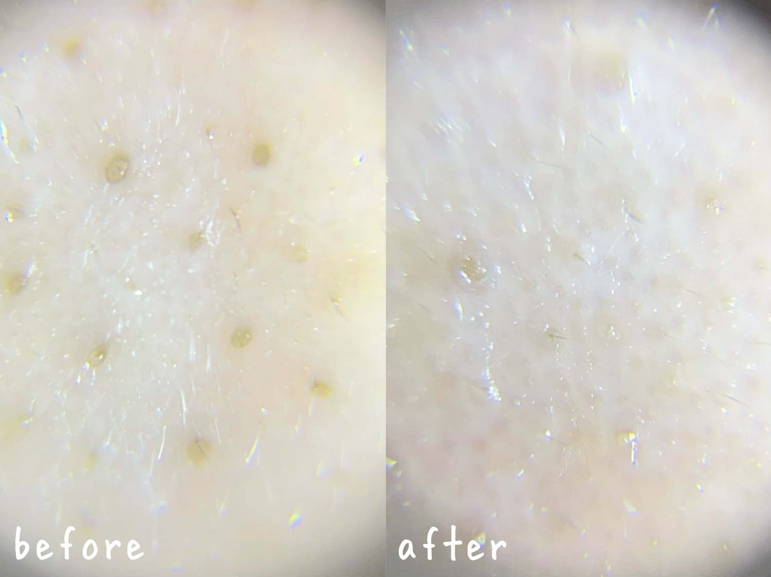 シカレチA クリーム0.05/VT/フェイスクリームを使ったクチコミ（2枚目）