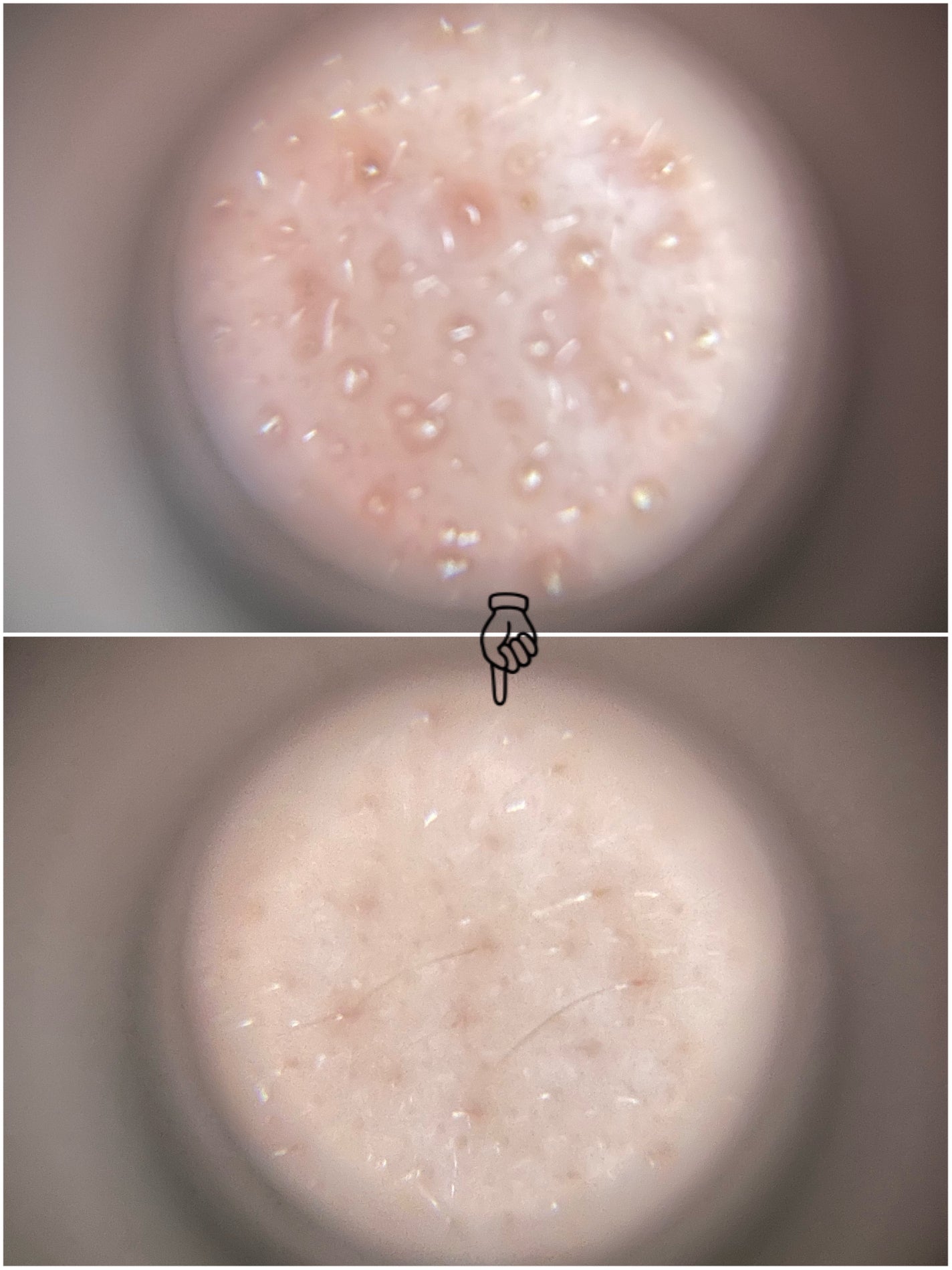 リードルショット300/VT/美容液を使ったクチコミ(6枚目)