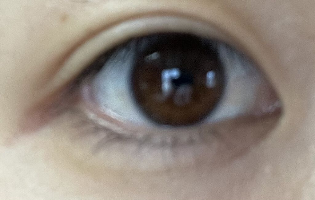 アイビューティー フィクサー WP/アストレア ヴィルゴ/二重まぶた用アイテムを使ったクチコミ（1枚目）