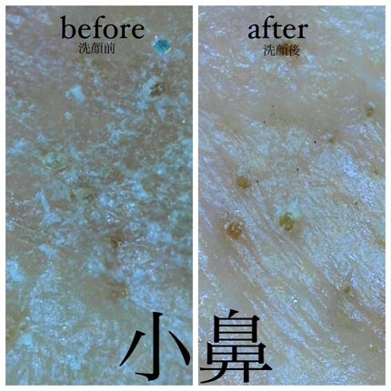 BALM CLEANSE メルティブラック/MELLIFE/クレンジングバームを使ったクチコミ(4枚目)