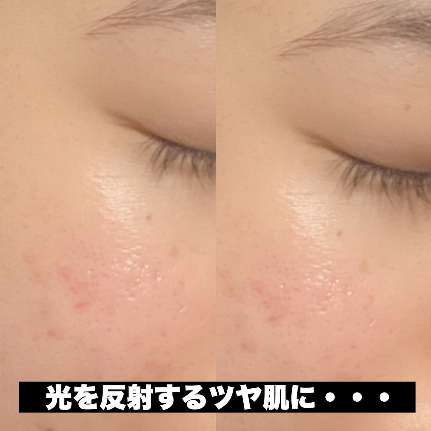 VC100エッセンスローション EX/ドクターシーラボⓇ/化粧水を使ったクチコミ(3枚目)