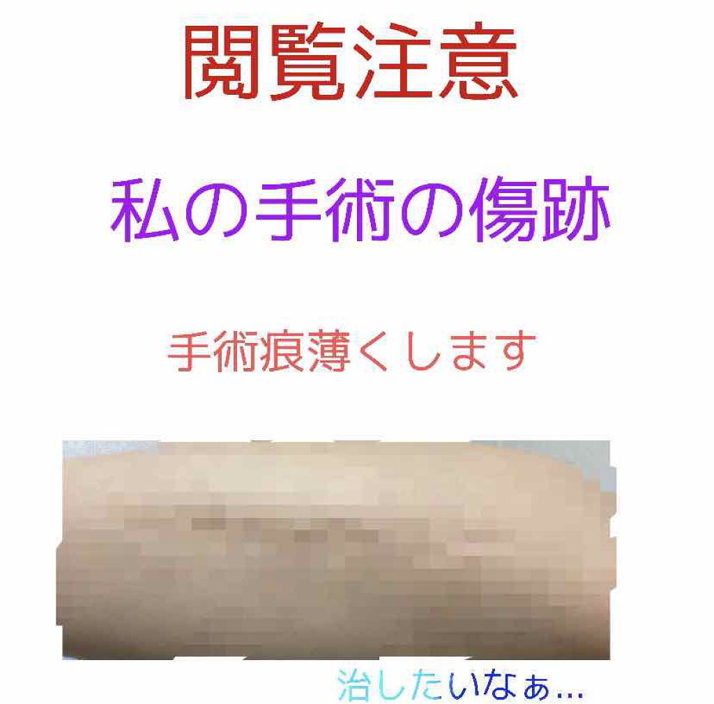 ピアソンHPクリーム(医薬品)/ピアソンHP/その他を使ったクチコミ(1枚目)