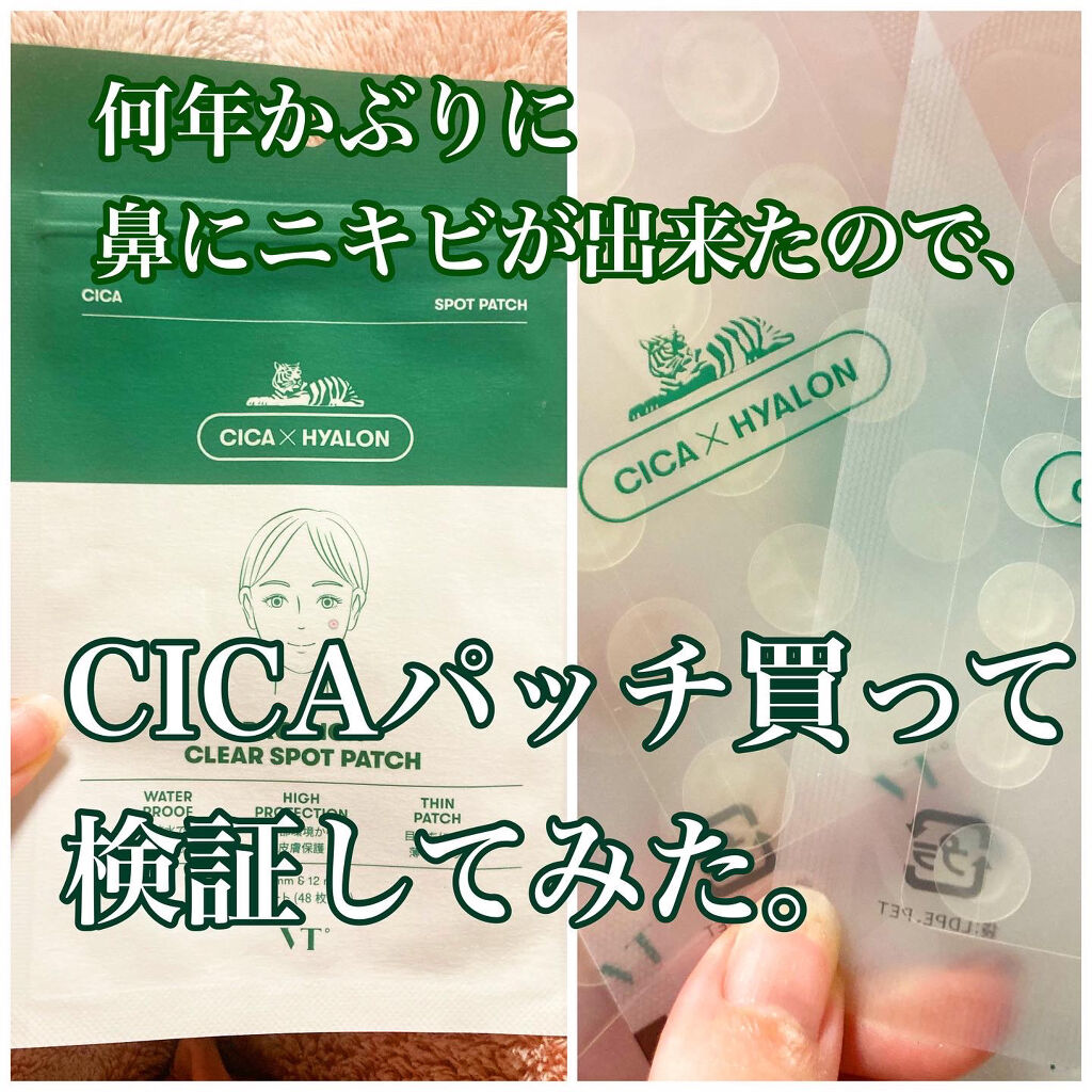 ニキビに効いた気はあまりせず、
ニキビ跡に効果はありました✨

後輩はニキビにも効いたと言っていたので人によるのかな？😖
手に取りやすいお値段なので購入してみるのはあり！