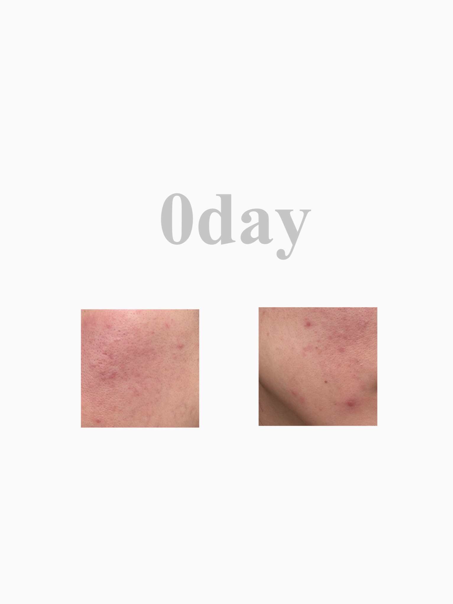 クリアフル ローションM(しっとりタイプ) つめかえ用 180ml/オルビス/化粧水を使ったクチコミ（3枚目）