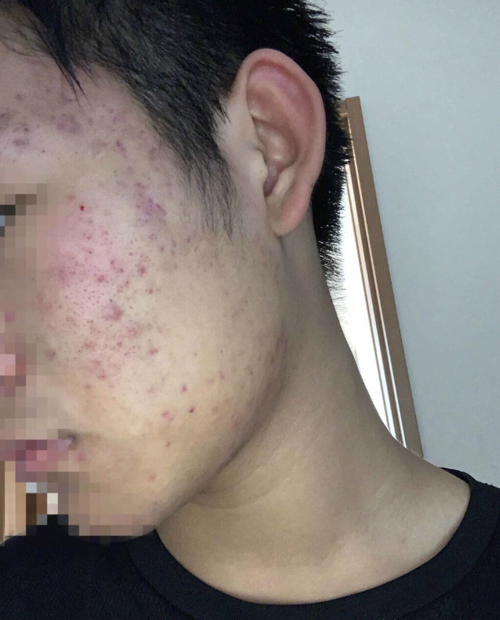 ハトムギ化粧水(ナチュリエ スキンコンディショナー R )/ナチュリエ/化粧水を使ったクチコミ（2枚目）