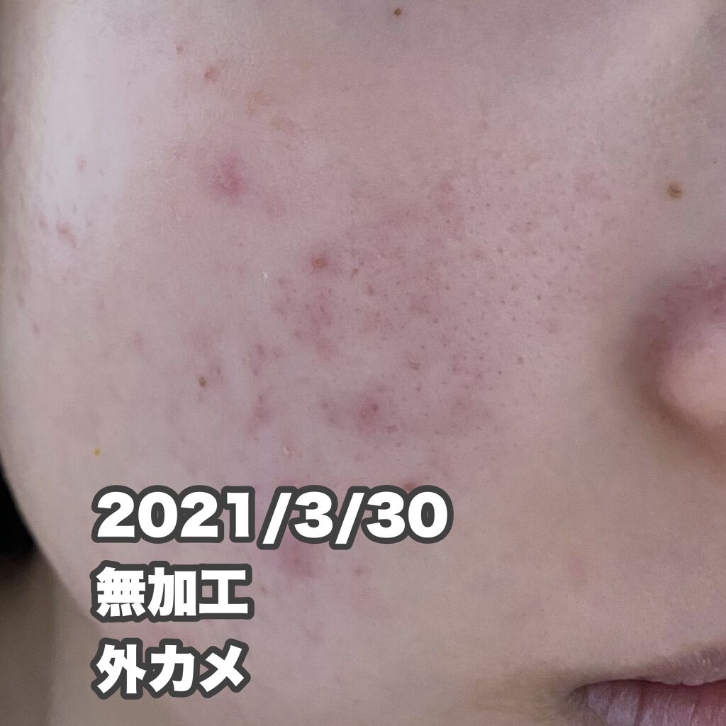 ドクタージャルト シカペア クリーム （第2世代）/Dr.Jart＋/フェイスクリームを使ったクチコミ（3枚目）