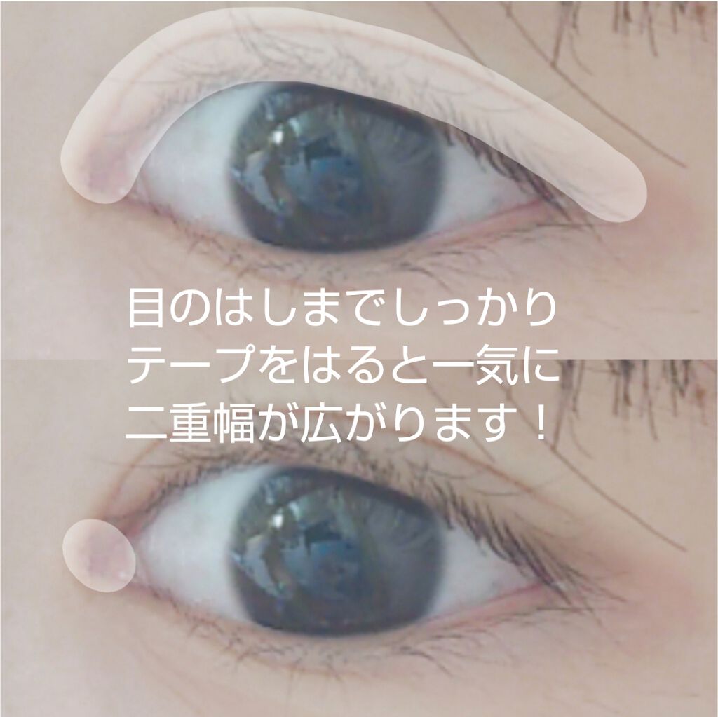 のびーるアイテープ(絆創膏タイプ、レギュラー)/DAISO/二重まぶた用アイテムを使ったクチコミ(2枚目)