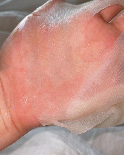 スキントラブルケア マスク/アルージェ/シートマスク・パックを使ったクチコミ(5枚目)