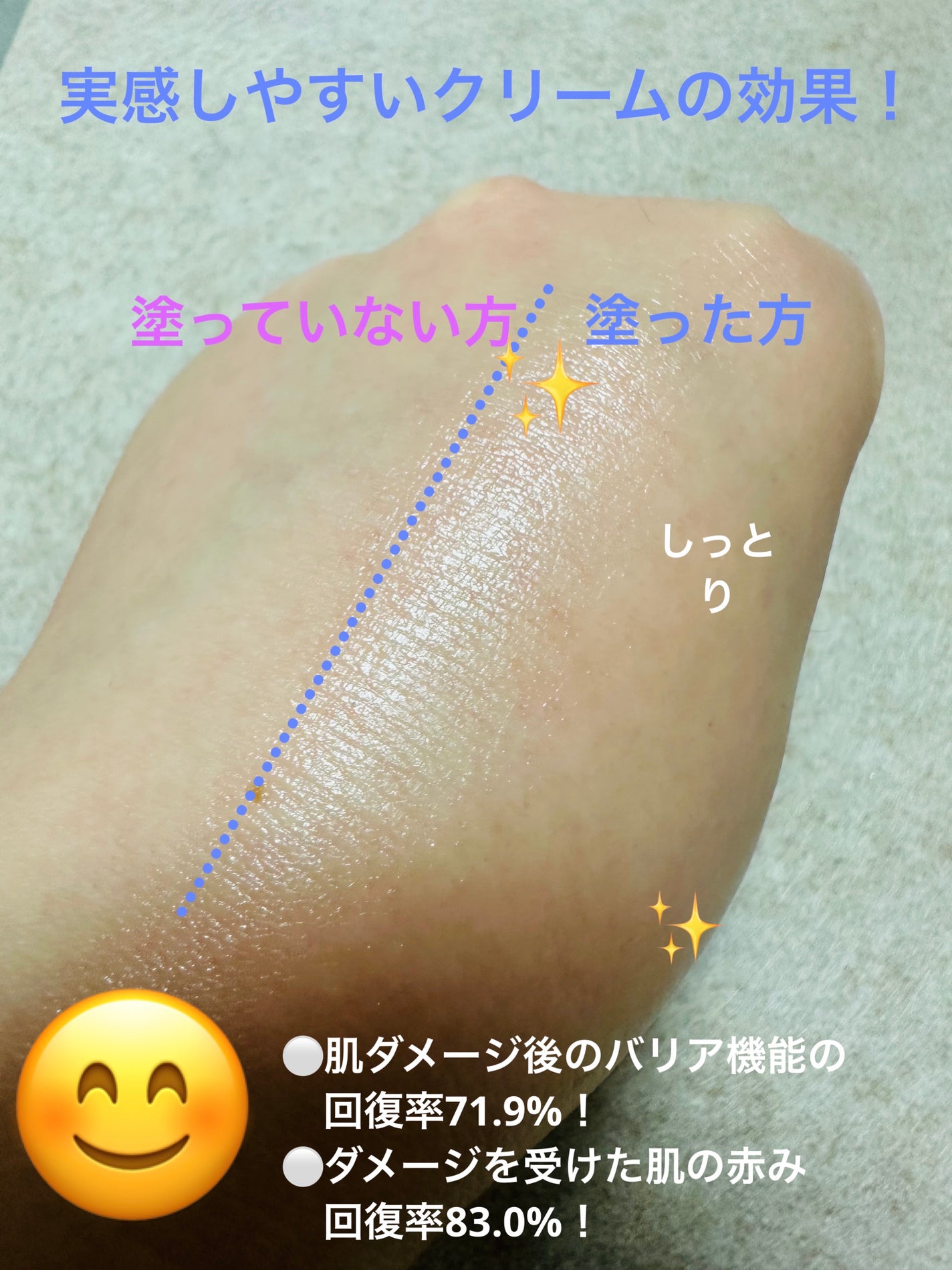 アイオペステムⅢクリーム/IOPE/フェイスクリームを使ったクチコミ(4枚目)