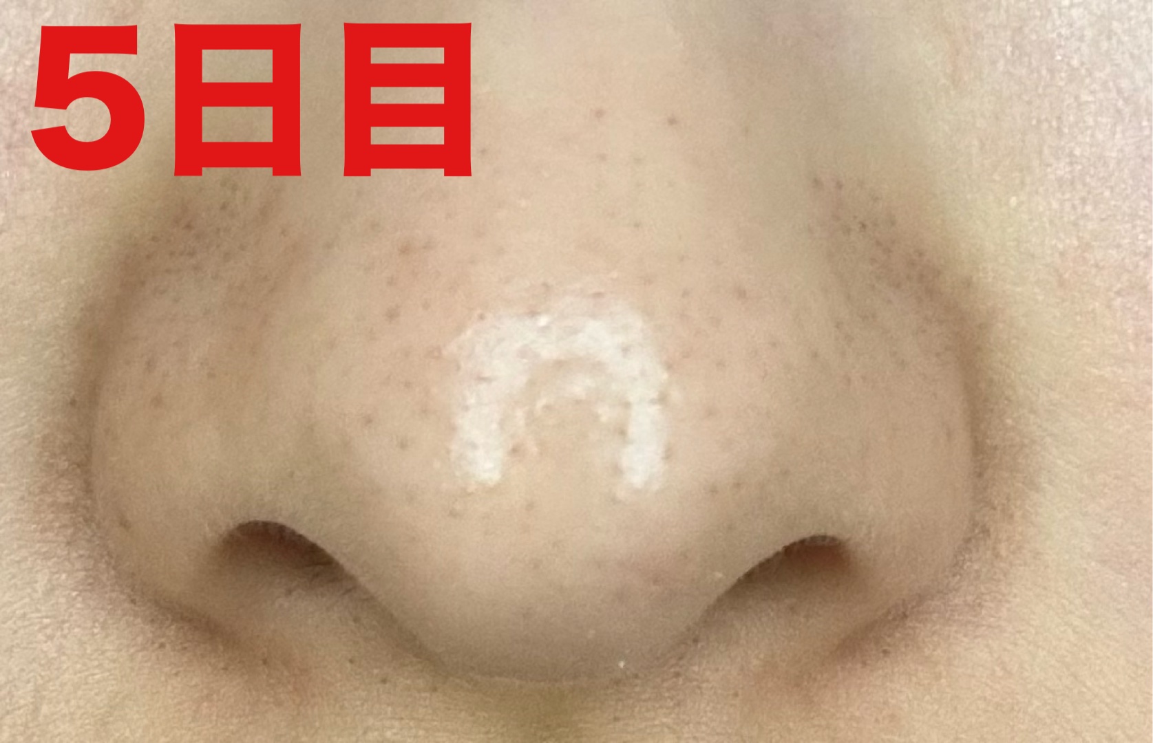 ディープクリア酵素洗顔	/メラノCC/洗顔フォームを使ったクチコミ（2枚目）