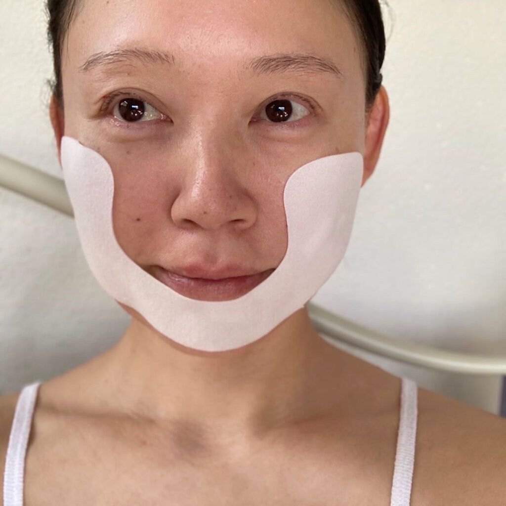 アンダーマスク/CELDERMA/シートマスク・パックを使ったクチコミ(5枚目)