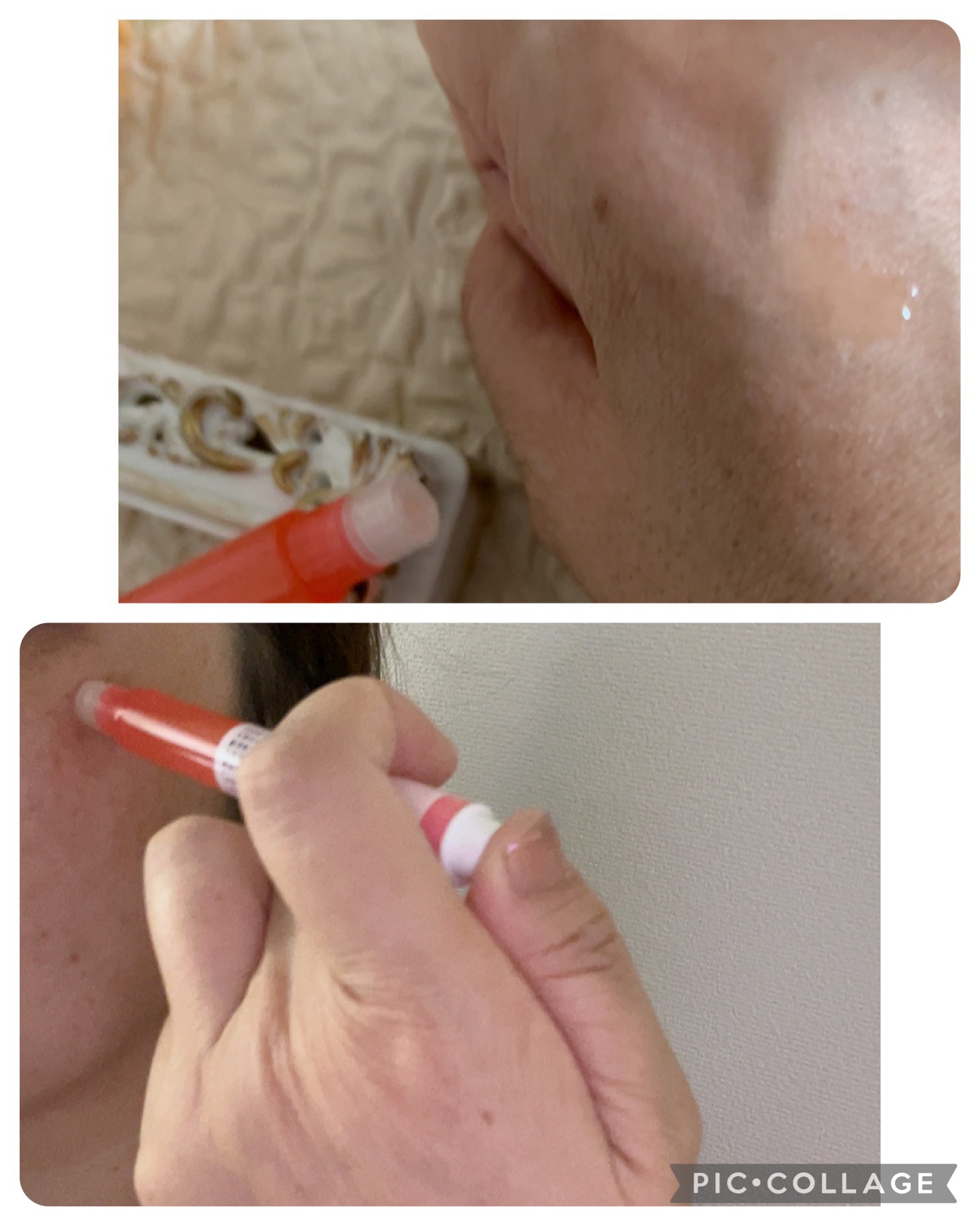 リンクル インジェクション/CONC/美容液を使ったクチコミ（3枚目）