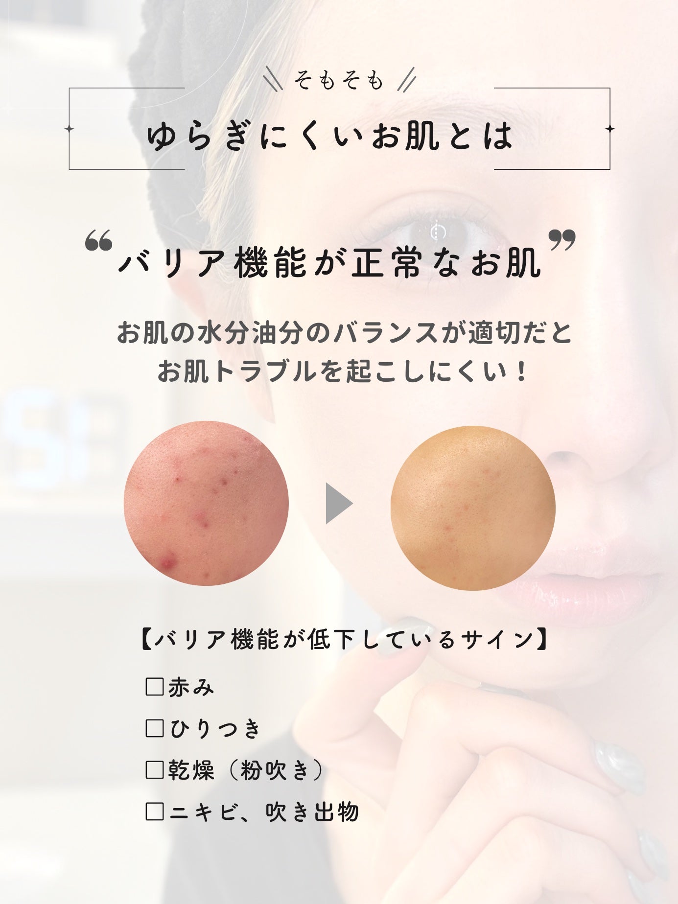 えむちゃん|3度のメシよりスキンケア on LIPS 「【花粉の季節必見🌷お肌がゆらいでいる時のNGスキンケア3選🙅..」(2枚目)