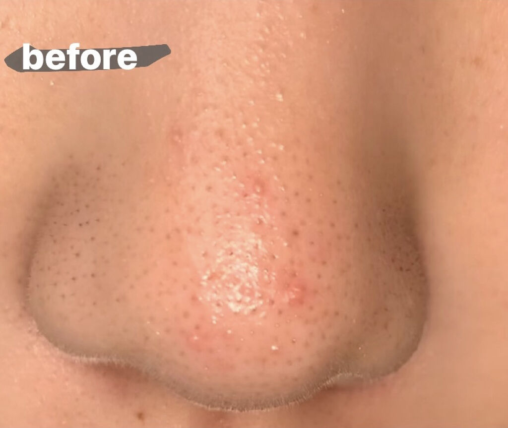 デュオ ザ クレンジングバーム ブラック/DUO/クレンジングバームを使ったクチコミ（2枚目）