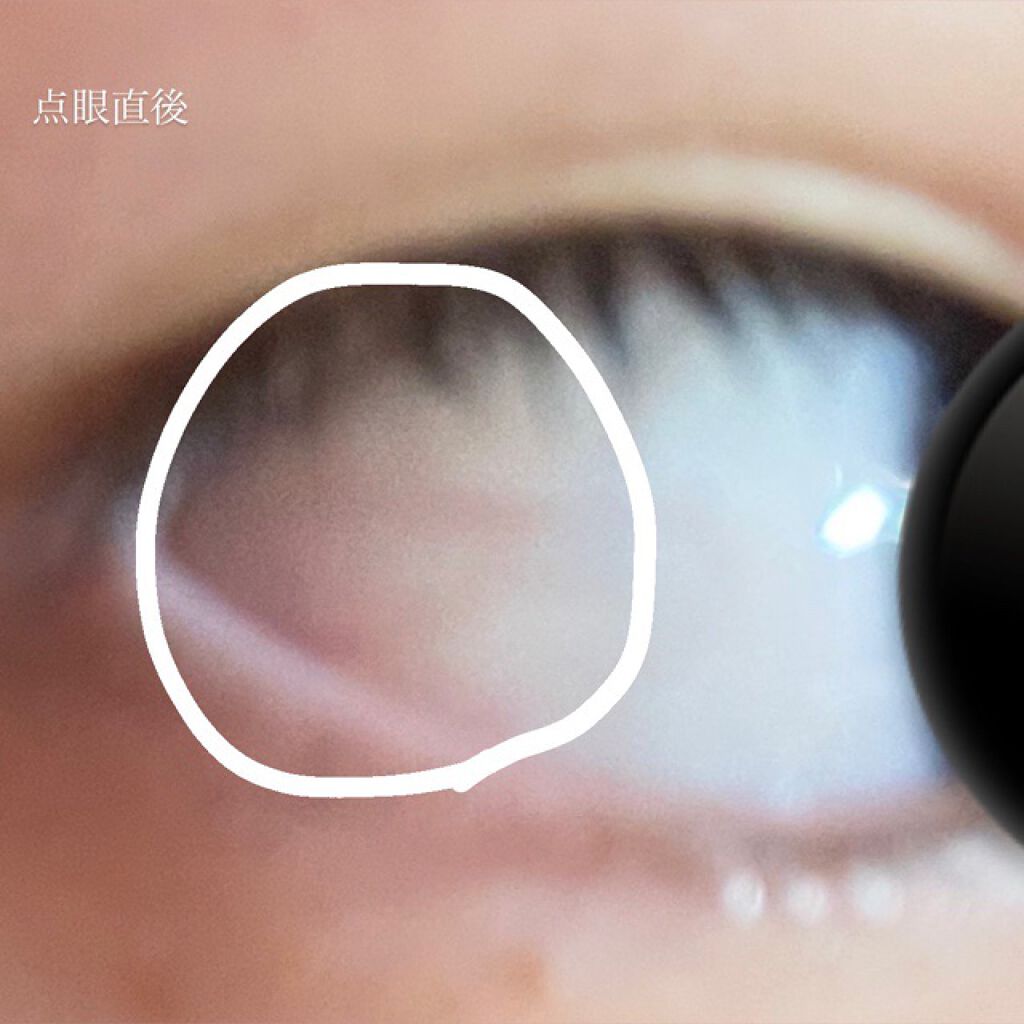 ロートリセ(医薬品)/ロート製薬/その他を使ったクチコミ（3枚目）