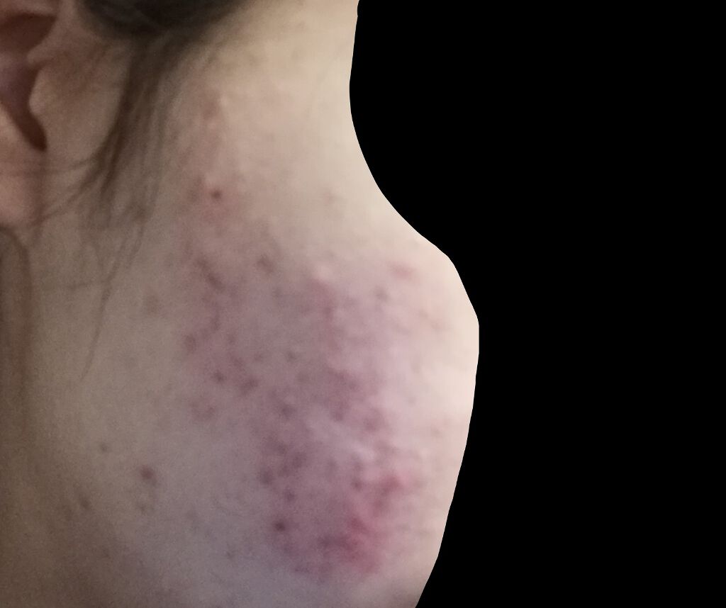 薬用しみ対策 美白化粧水/メラノCC/化粧水を使ったクチコミ（2枚目）