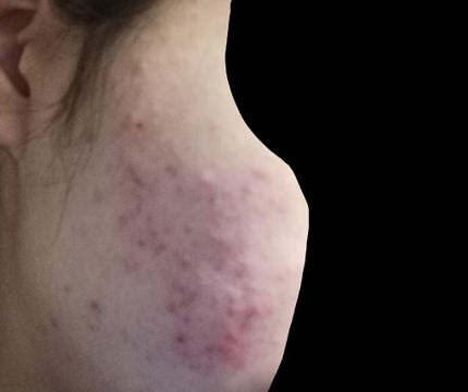 薬用しみ対策 美白化粧水/メラノCC/化粧水を使ったクチコミ(2枚目)