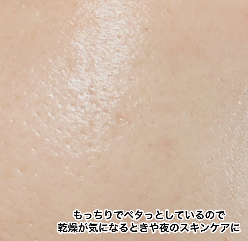 REJURAN モイスチャートリートメントアンプル /REJURAN COSMETICS/美容液を使ったクチコミ(5枚目)