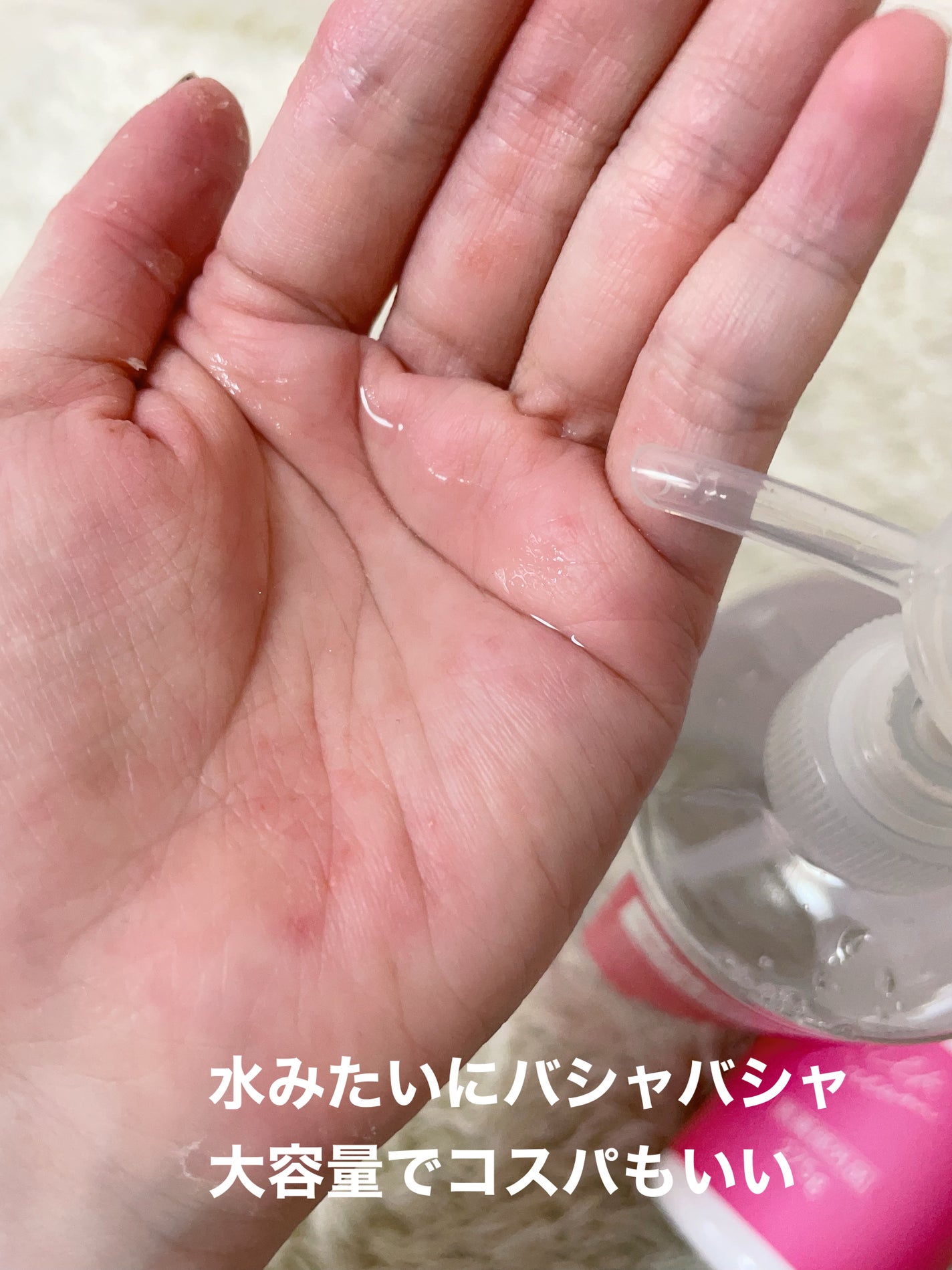 ヘパトリート 薬用保湿化粧水/ゼトックスタイル/化粧水を使ったクチコミ(2枚目)