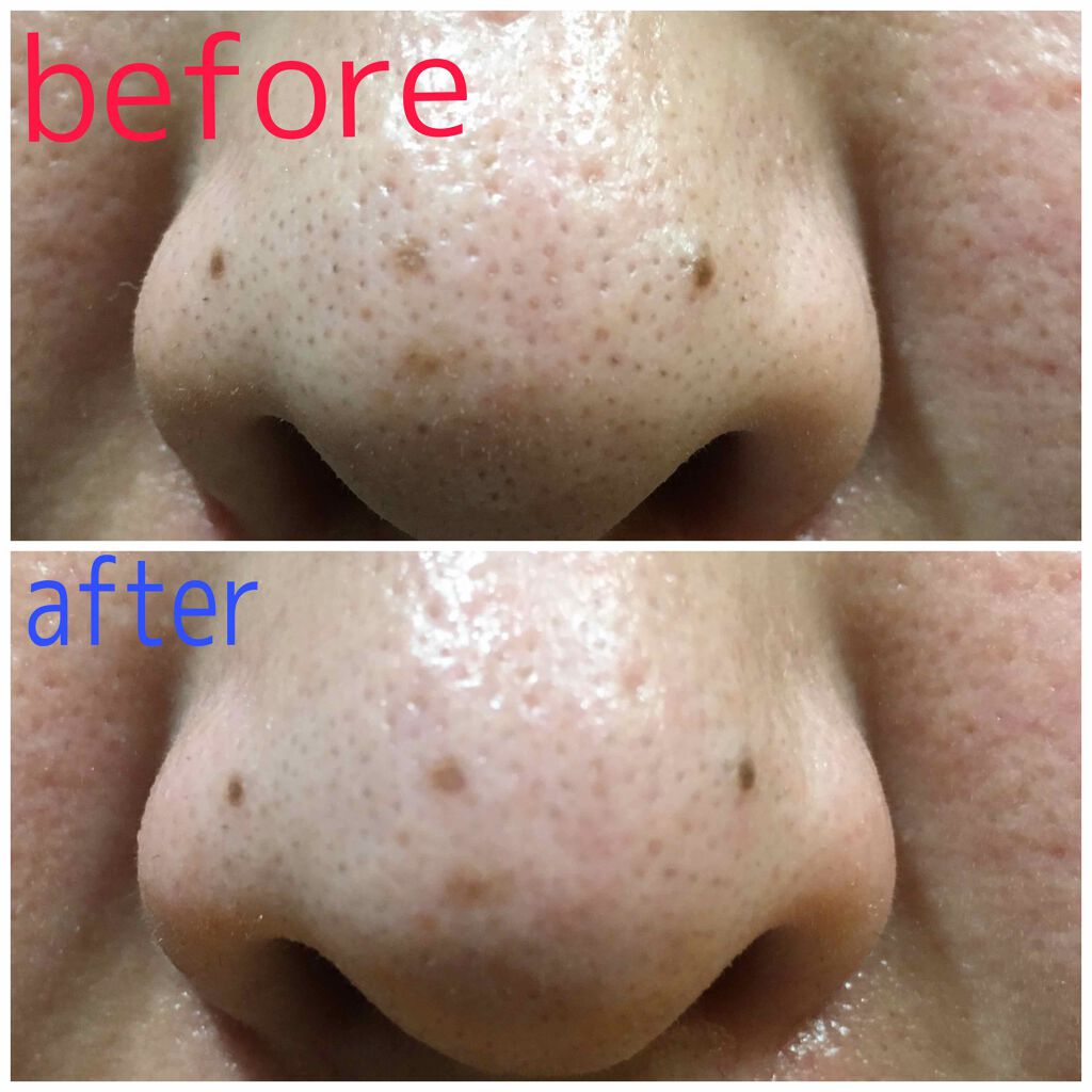 ガスール固形/ナイアード/洗顔石鹸を使ったクチコミ（2枚目）