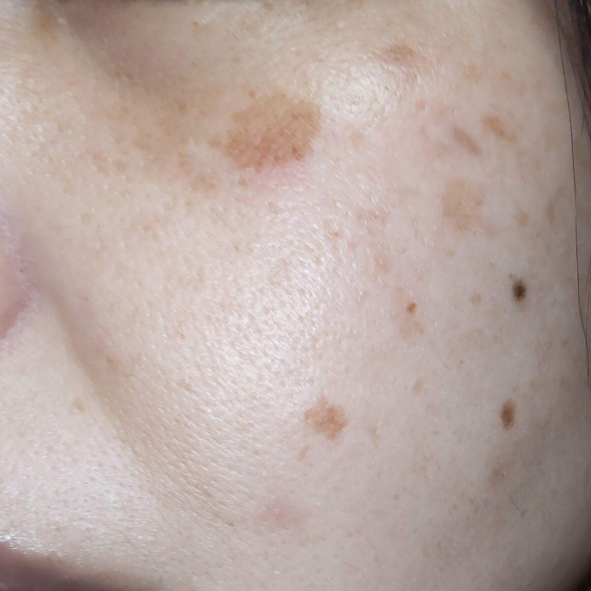 コアバランス トーニングローション/athletia/化粧水を使ったクチコミ(7枚目)