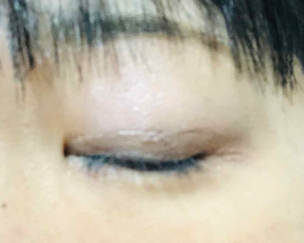 ハイブリッドフィルム/アイトーク/二重まぶた用アイテムを使ったクチコミ(2枚目)