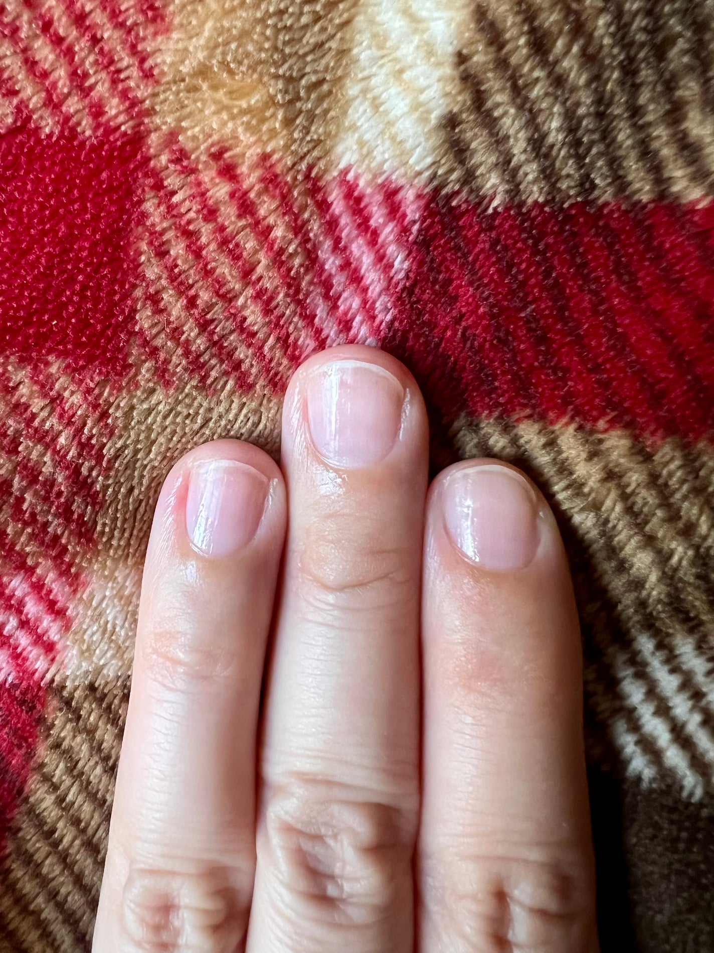 Mimits モイストネイルオイル/ビー・エヌ/ネイルオイル・トリートメントを使ったクチコミ(6枚目)