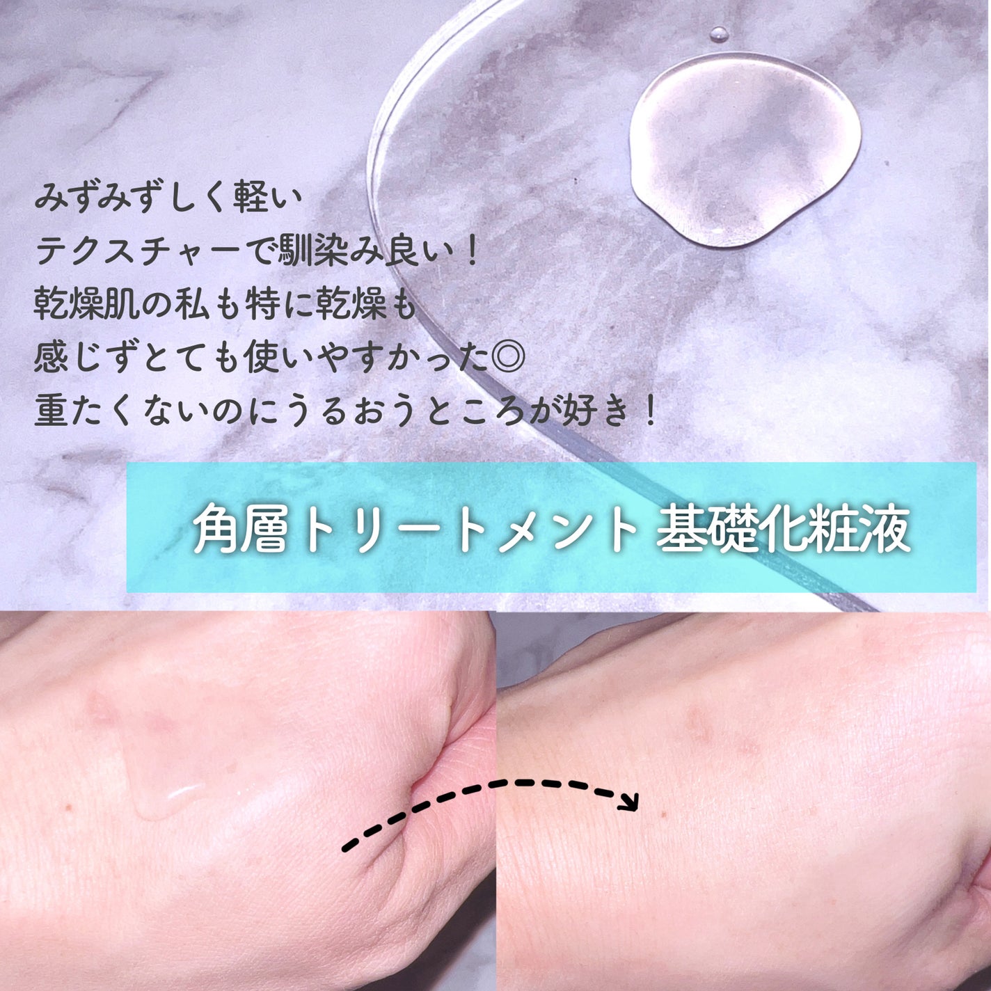 ソフィーナ iP 角層トリートメント 基礎化粧液/SOFINA iP/化粧水を使ったクチコミ(3枚目)