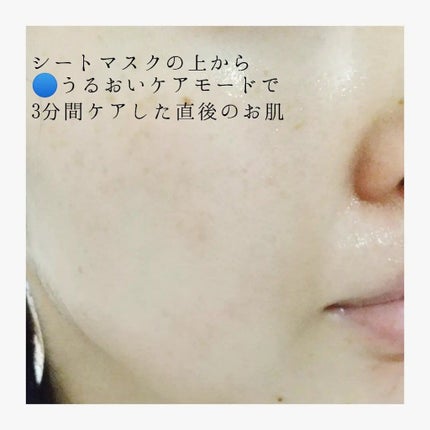 スキンライトセラピーII/Makeon/美顔器・マッサージを使ったクチコミ(7枚目)