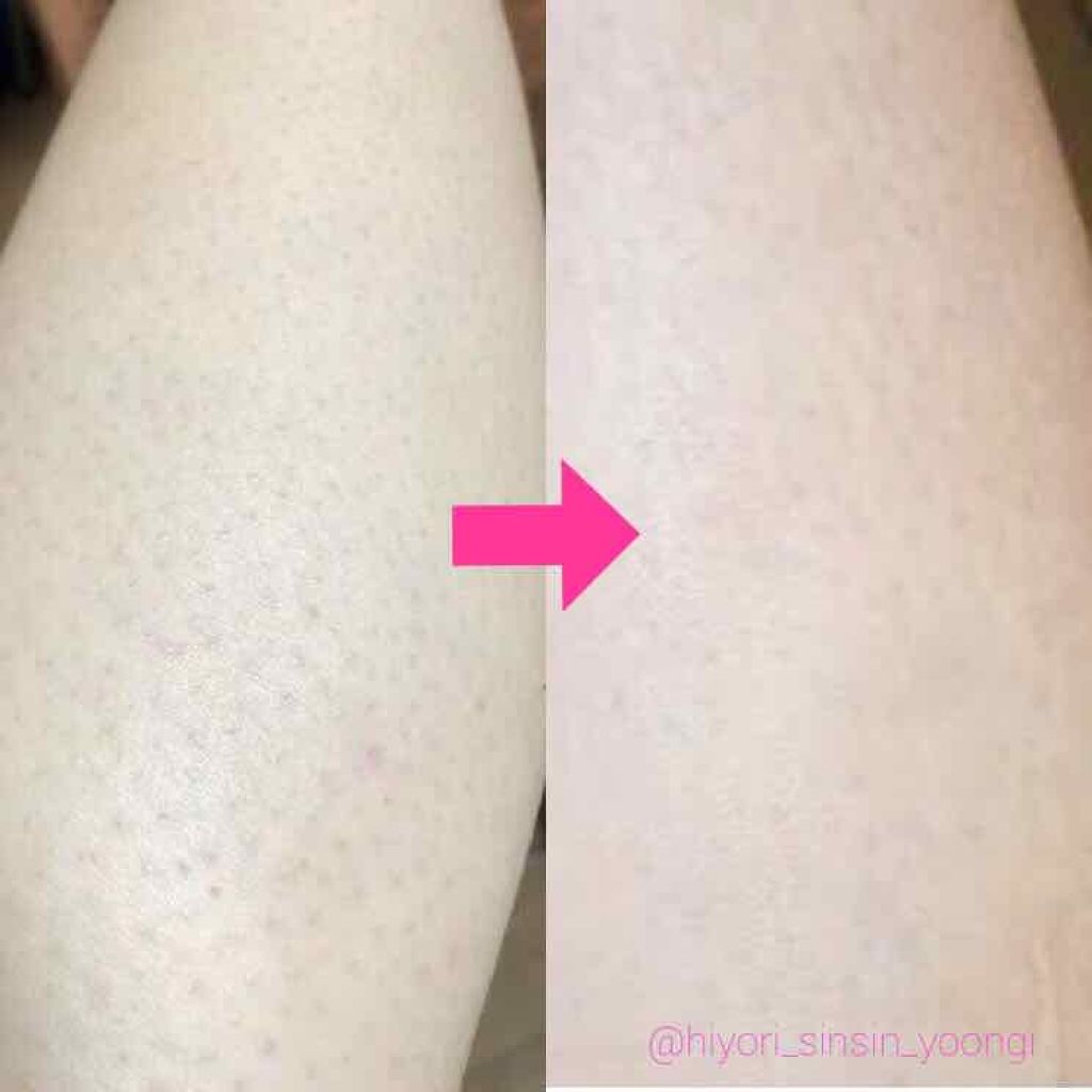 シーズンズ アフターケアトリートメント<ハード>/SEASONS/ボディローションを使ったクチコミ(2枚目)